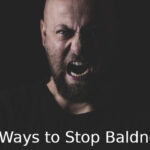 Hair Loss: 5 Ways to stop baldness