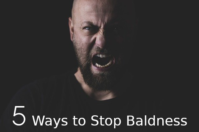 Ways-stop-baldness